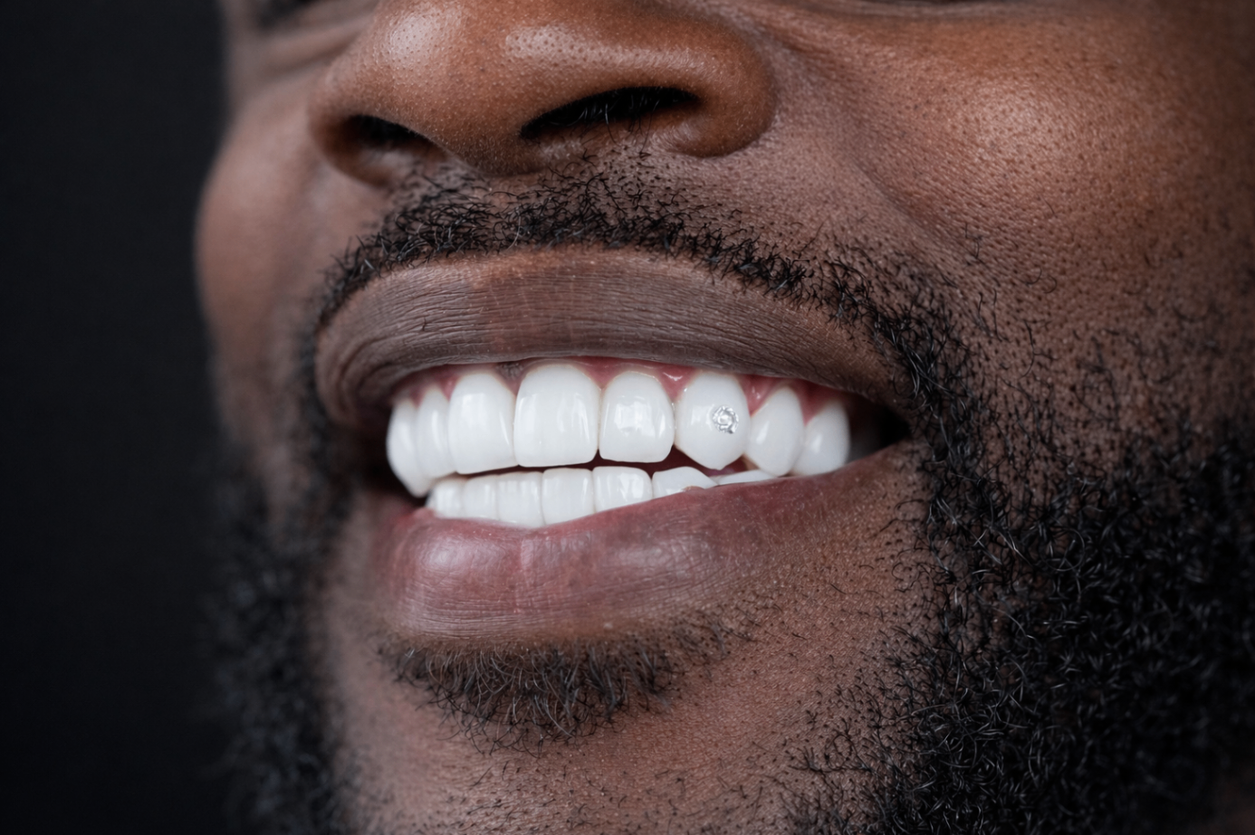 Smile transformation 1