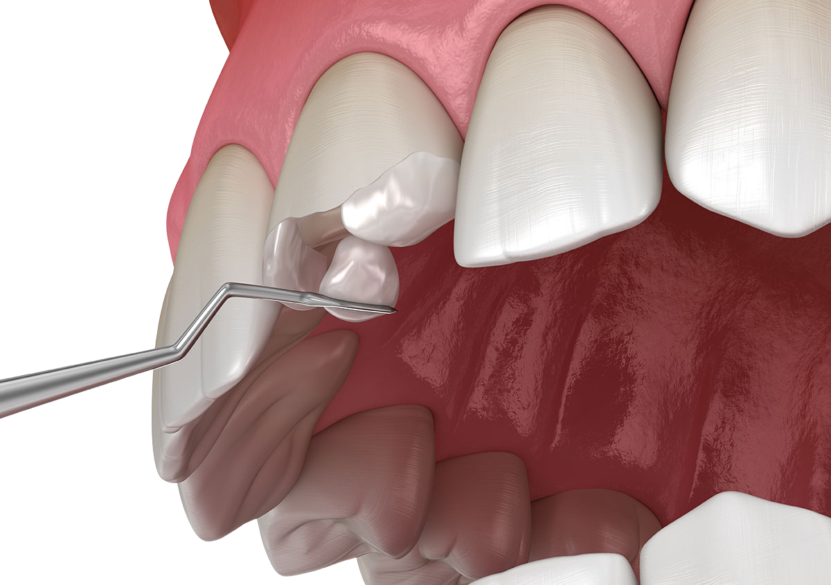 Restoration Dentistry