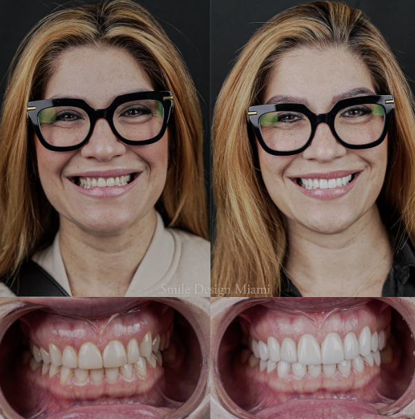 Professional Teeth Cleaning
