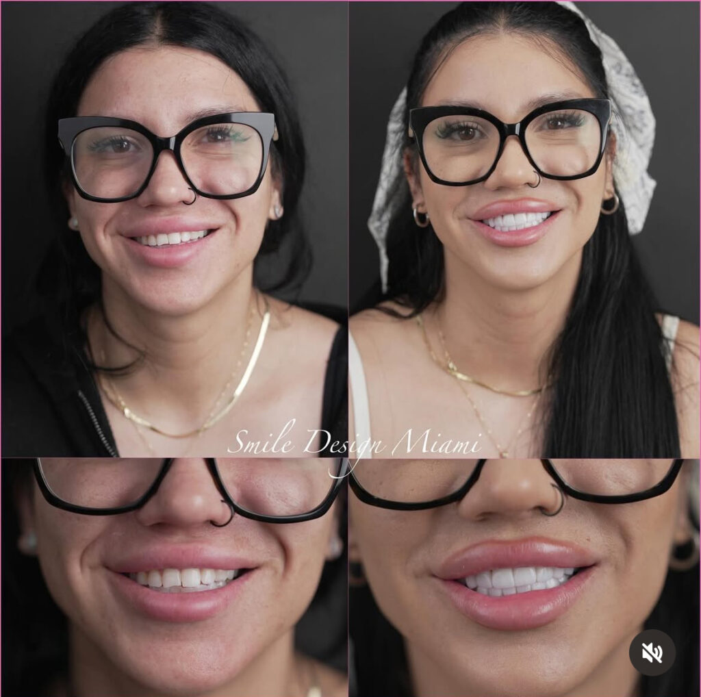 smile design miami